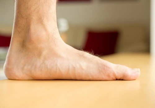 Flat Feet Signs and Symptoms - Belridge Podiatry