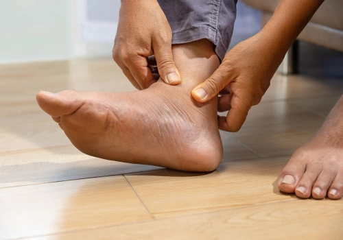 Plantar Heel Pain​ Causes - Belridge Podiatry