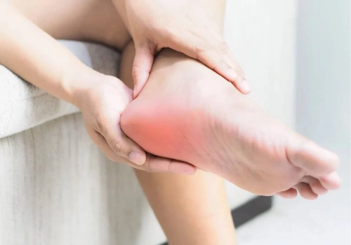 Plantar Heel Pain​ Treatment - Belridge Podiatry